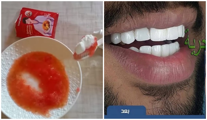 خلطة الطماطم وبيكاربونات الصودا لتبييض الاسنان