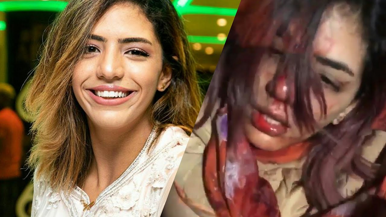 مغنية مغربية شابة تتعرض لاعتداء وحشي بمدينة الصخيرات