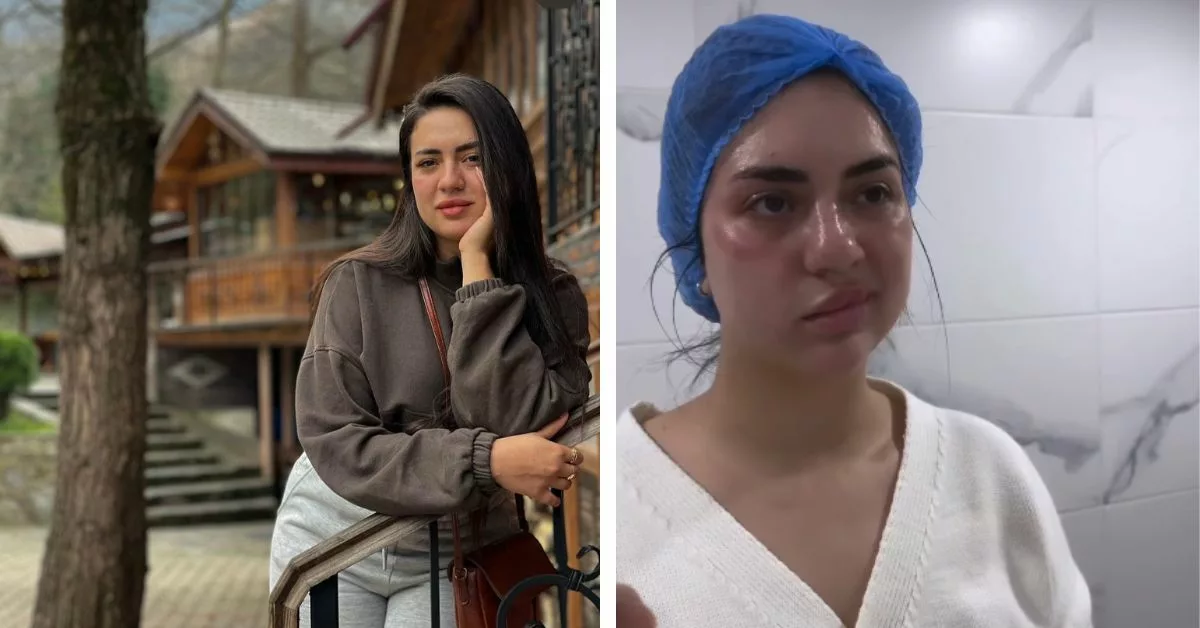 في مقطع فيديو رباب الباني تعلن عن شفائها من شلل الوجه النصفي