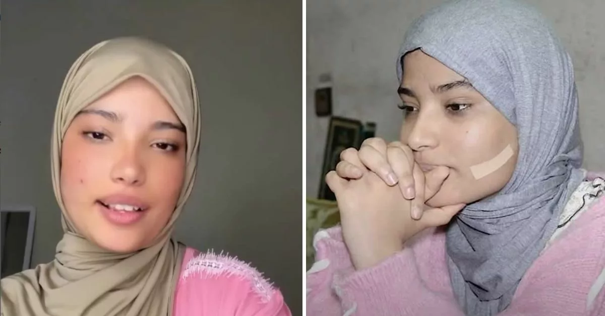 التلميذة سلمى تشارك فرحتها بنجاح العملية التجميلية