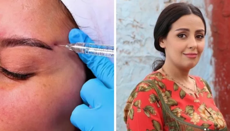 فدوى طالب تكشف عن تعديلات تجميلية في وجهها بجرأة وشفافية