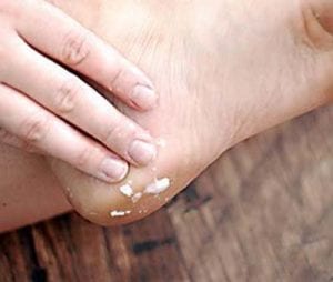 علاج سريع لتشقّقات كعب القدمين remede_rapide_talons_fendilles6 (1)