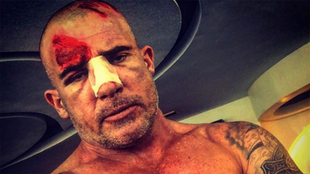 بطل prison break يتعرض لكسور في الرأس و الأنف خلال التصوير بورزازات