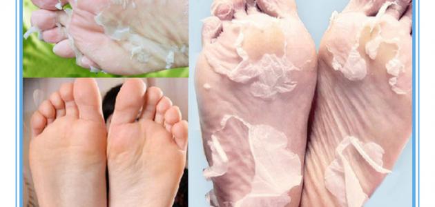 طريقة طبيعية لتقشير القدمين و ازالة الجلد الميت لتنعمي بقدمين ناعمتين
