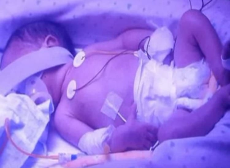 معجزة...طفل يولد بعد 107 أيام من موت أمه