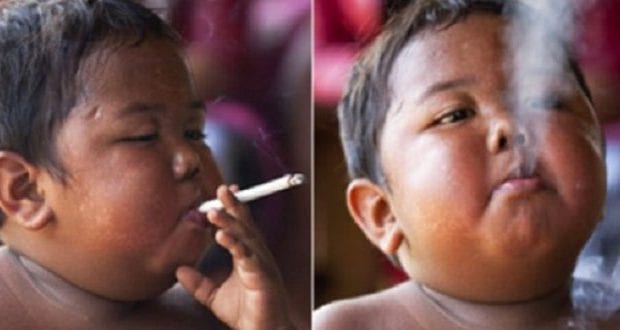 هذا الطفل كان يدخن 40 سيجارة في اليوم...انظروا كيف أصبح اليوم