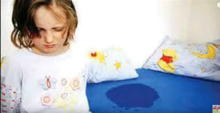 تمرينات مفيدة لعلاج التبول اللارادي عند الأطفال فعال ونهائي بأذن الله