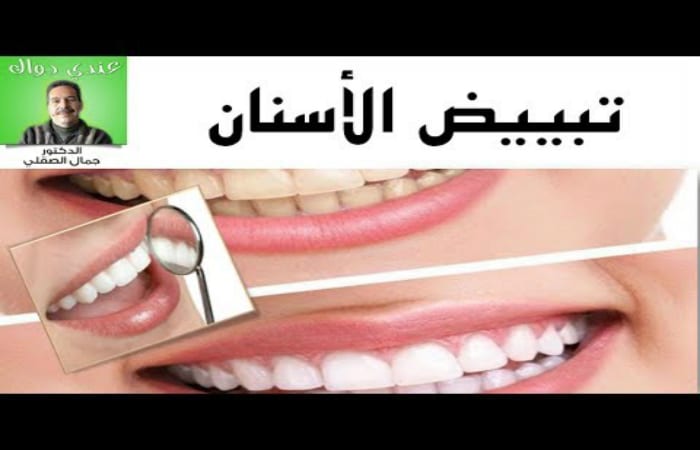 الوصفة المعجزة التي فصح عنها مؤخرا الدكتور جمال الصقلي والفعالة في تبييض الأسنان وعلاج اللثة