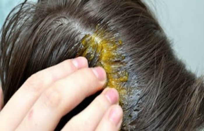 وصفة سحرية لإعادة إنبات الشعر من جديد وملء الفراغات في إسبوع واحد