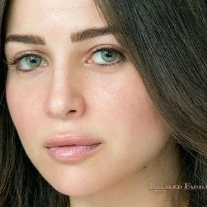 مي عز الدين تقوم بعملية تجميل لأنفها...شاهدوا كيف أصبحت!! مي عز الدين تقوم بعملية تجميل لأنفها...شاهدوا كيف أصبحت!!