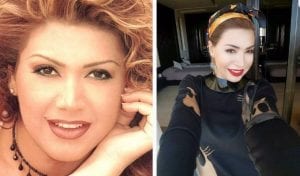 بالصور : شاهد كيف كانت أسنان النجمات قبل الشهرة...يعني ديما كاين أمل !!!