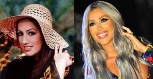 بالصور : شاهد كيف كانت أسنان النجمات قبل الشهرة...يعني ديما كاين أمل !!!