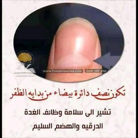 لون أظافرك قد يدل على إصابتك بأمراض خطييرة... تعرفوا إليها! لون أظافرك قد يدل على إصابتك بأمراض خطييرة... تعرفوا إليها!