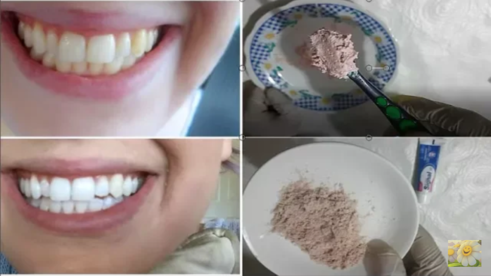 وصفتي البسيطة في تبييض الأسنان في 3 دقائق بمكون عجيب نتخلص منه يوميا..مضمونة 100%