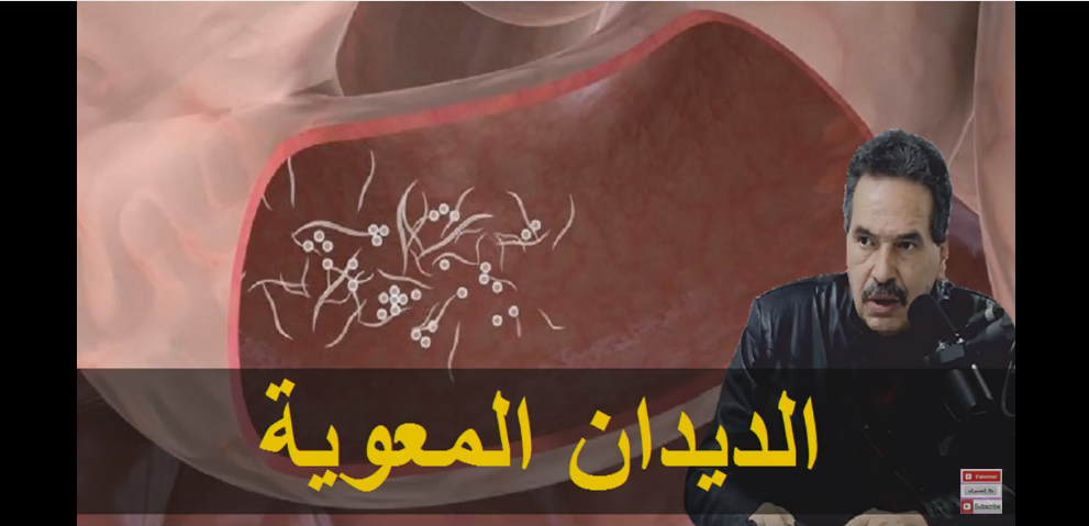 الدكتور جمال الصقلي يقدم العلاج النهائي للديدان المعوية و المعدية عند الأطفال