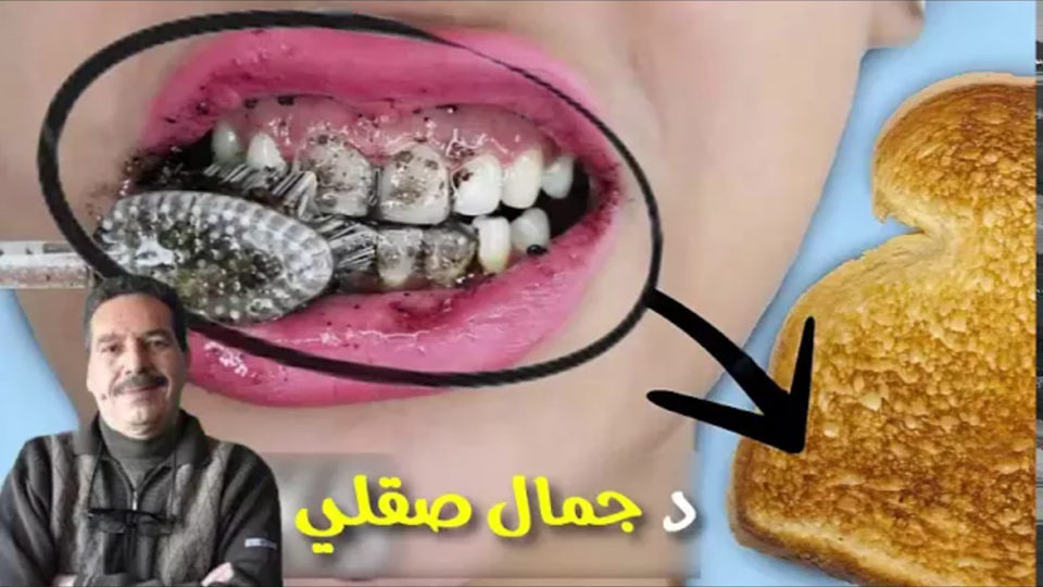 وصفة لن تصدقي أنها فعالة في تبييض الأسنان حتى تجربيها مع الدكتور جمال الصقلي