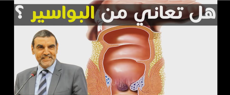 الدكتور محمد فايد يقدم للمغاربة أفضل الطرق لتجاوز مشكل البواسير نهائيا