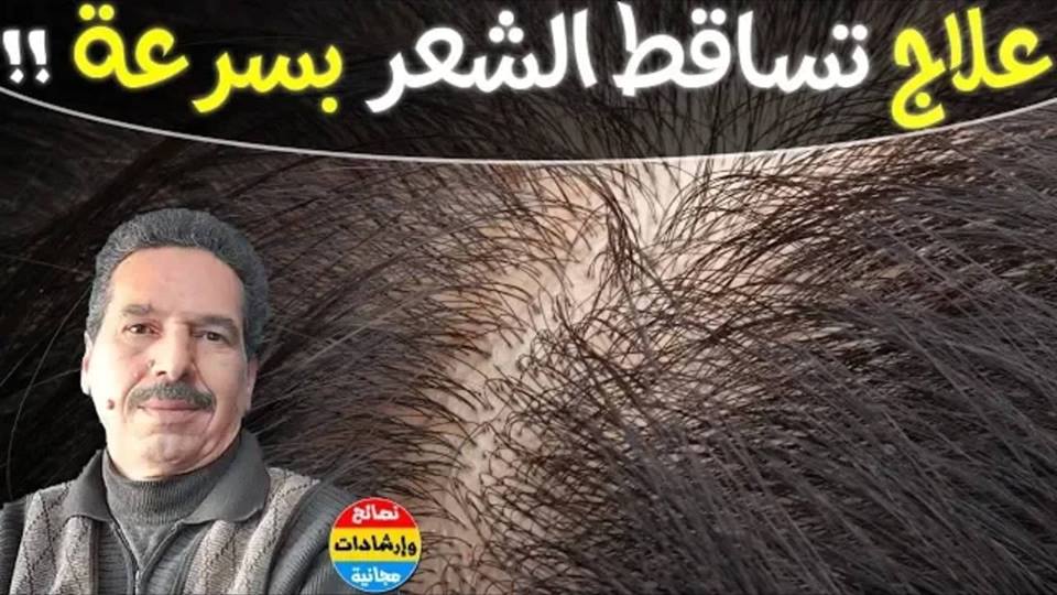 الوصفة التي تبحث عنها النساء توقف تساقط الشعر وتنبته من جديد مع الدكتور جمال الصقلي