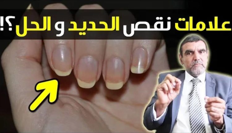 لكل من تعاني من نقص في الحديد !! الحل مع الدكتور محمد الفايد