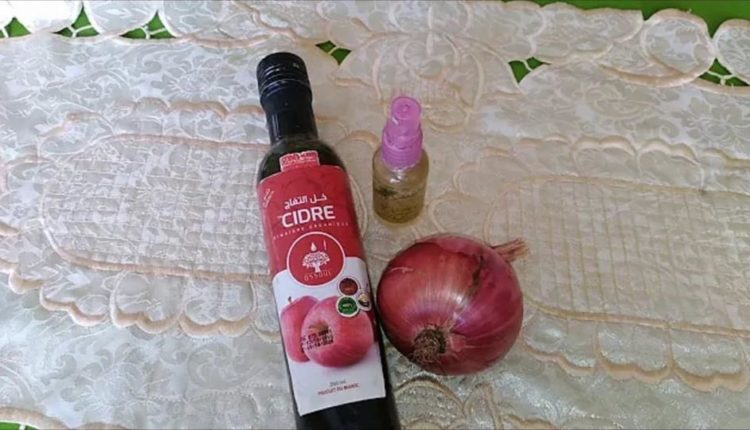 وصفة البصل و خل التفاح لتخفيف الكلف و التصبغات