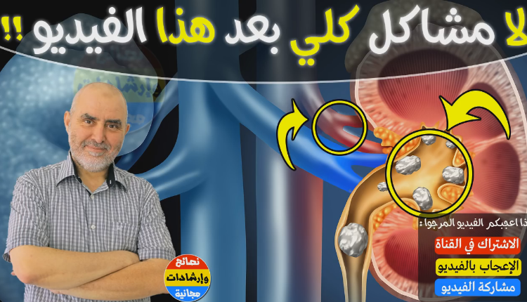 الدكتور كريم العلوي يقدم العلاج النهائي لمشاكل و حجر الكلي