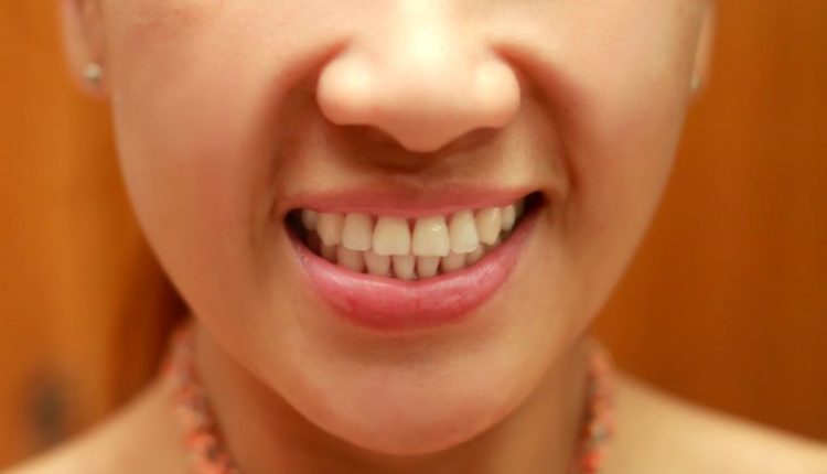 وصفة ب2 مكونات لتبييض الاسنان ريحتها كتحمق و النتيجة من اليوم الأول