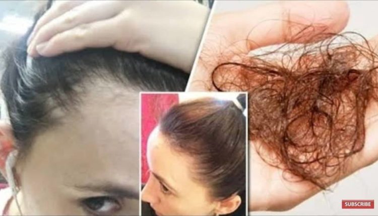 علاج تساقط الشعر في فصل الخريف وترطيبه من الجذور وبوصفة سريعة وآمنة