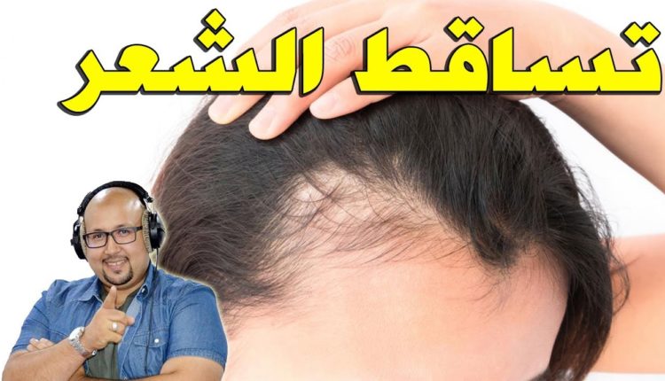 وصفة لعلاج تساقط الشعر مشكل القشرة والترطيب مع الدكتور عماد ميزاب