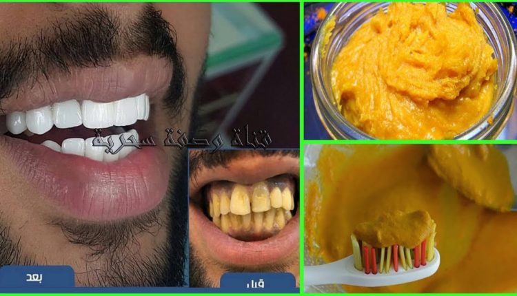 وصفة هندية معجزة في تبييض الأسنان في دقيقتين وإزالة الإصفرار من الفركة الأولى