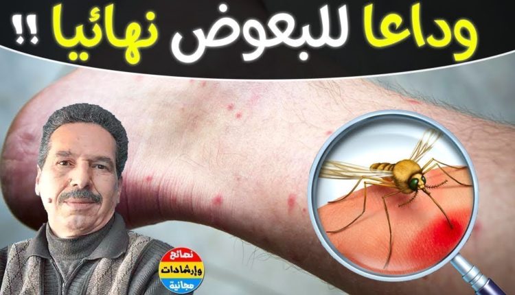 جمال الصقلي الوصفة السحرية لطرد كل البعوض من منزلك وعلاج ألم لدغات الناموس