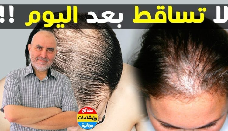 الدكتور كريم العلوي يقدم 3 وصفات طبيعية اذا اتبعتها السيدات لن تصاب أبدا بتساقط الشعر